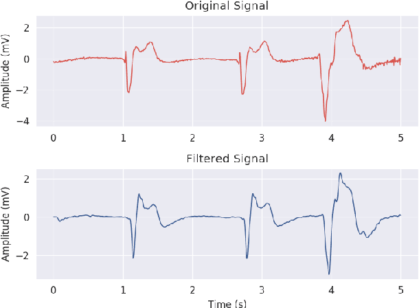 Figure 1 for VFPred: A Fusion of Signal Processing and Machine Learning techniques in Detecting Ventricular Fibrillation from ECG Signals