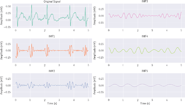 Figure 3 for VFPred: A Fusion of Signal Processing and Machine Learning techniques in Detecting Ventricular Fibrillation from ECG Signals