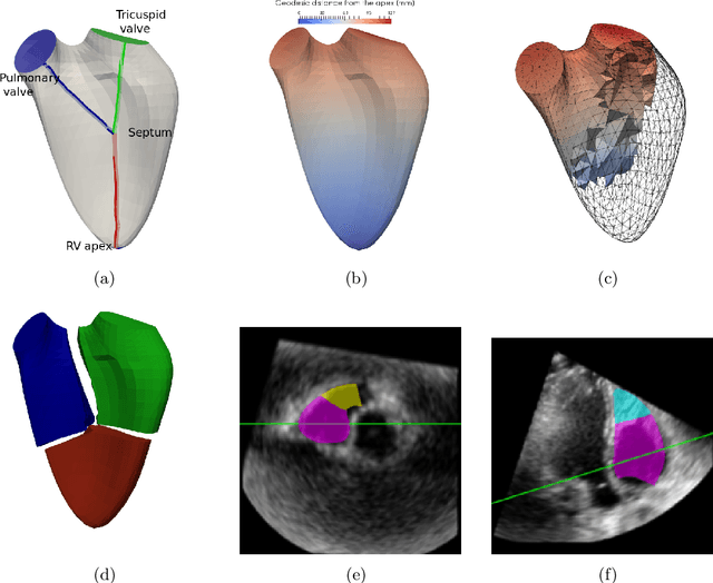 Figure 1 for Volumetric parcellation of the right ventricle for regional geometric and functional assessment