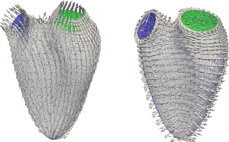 Figure 3 for Volumetric parcellation of the right ventricle for regional geometric and functional assessment