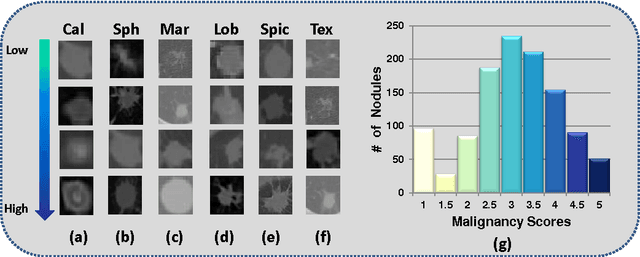Figure 1 for Risk Stratification of Lung Nodules Using 3D CNN-Based Multi-task Learning