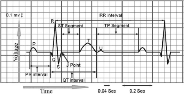 Figure 1 for Two-stream Network for ECG Signal Classification