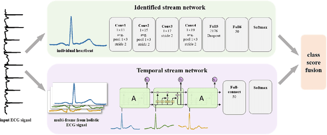 Figure 3 for Two-stream Network for ECG Signal Classification