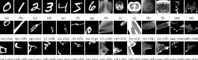Figure 3 for Image Augmentation using Radial Transform for Training Deep Neural Networks