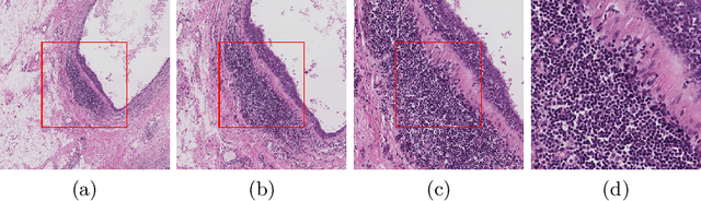 Figure 3 for Reinforced Auto-Zoom Net: Towards Accurate and Fast Breast Cancer Segmentation in Whole-slide Images