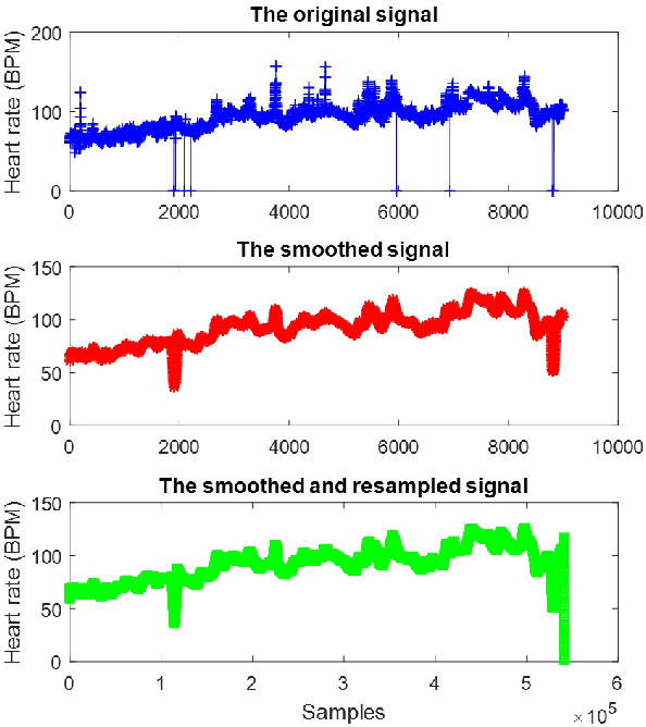 Figure 3 for Early Hospital Mortality Prediction using Vital Signals