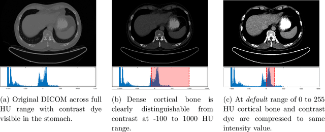 Figure 4 for Bone Segmentation in Contrast Enhanced Whole-Body Computed Tomography