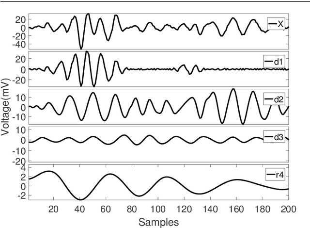 Figure 1 for Microwave breast cancer detection using Empirical Mode Decomposition features