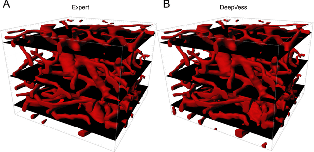 Figure 3 for Deep convolutional neural networks for segmenting 3D in vivo multiphoton images of vasculature in Alzheimer disease mouse models