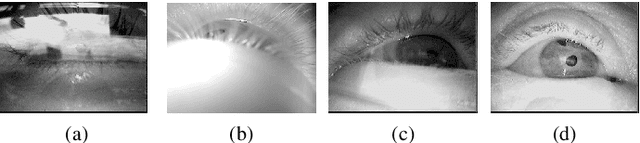 Figure 1 for PuRe: Robust pupil detection for real-time pervasive eye tracking
