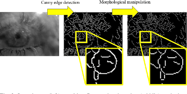 Figure 3 for PuRe: Robust pupil detection for real-time pervasive eye tracking