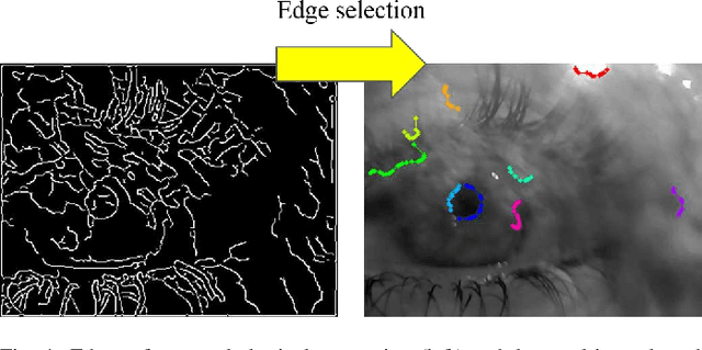 Figure 4 for PuRe: Robust pupil detection for real-time pervasive eye tracking