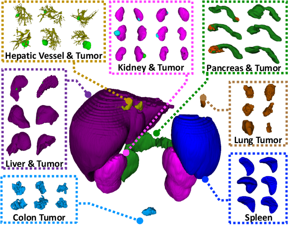 Figure 1 for DoDNet: Learning to segment multi-organ and tumors from multiple partially labeled datasets