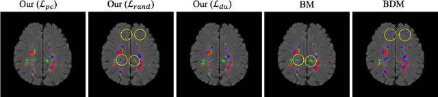 Figure 3 for Scanner Invariant Multiple Sclerosis Lesion Segmentation from MRI