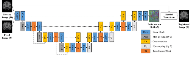 Figure 1 for A Transformer-based Network for Deformable Medical Image Registration