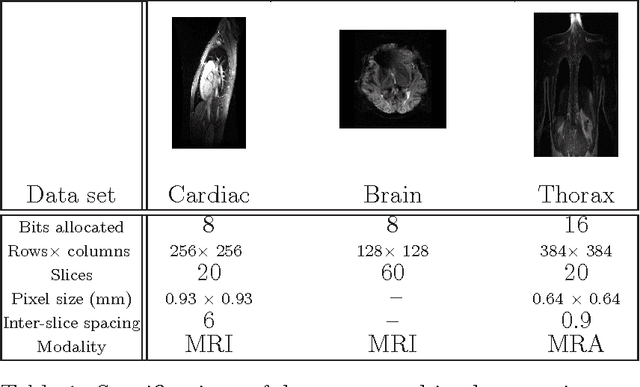 Figure 2 for Dependent Nonparametric Bayesian Group Dictionary Learning for online reconstruction of Dynamic MR images