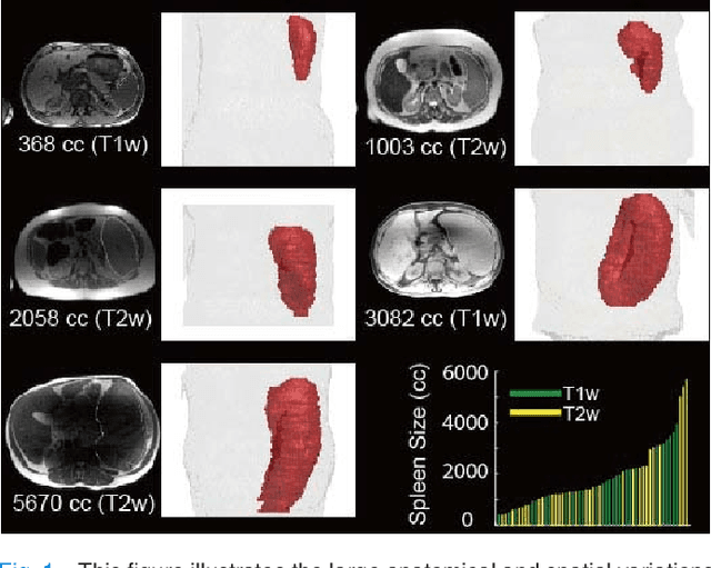 Figure 1 for Splenomegaly Segmentation on Multi-modal MRI using Deep Convolutional Networks