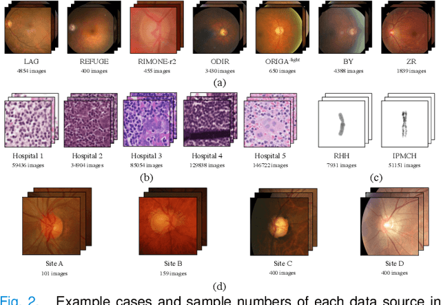 Figure 2 for A simple normalization technique using window statistics to improve the out-of-distribution generalization on medical images