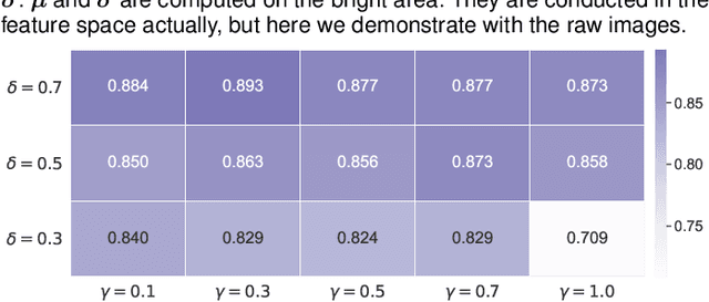 Figure 3 for A simple normalization technique using window statistics to improve the out-of-distribution generalization in medical images