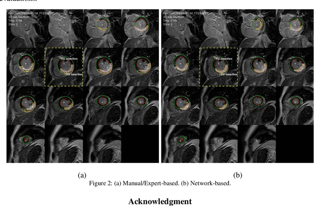 Figure 2 for Evaluation of deep learning-based myocardial infarction quantification using Segment CMR software