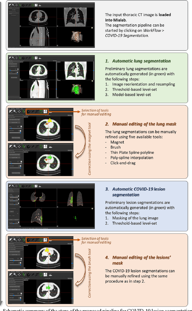 Figure 1 for Development and evaluation of a 3D annotation software for interactive COVID-19 lesion segmentation in chest CT