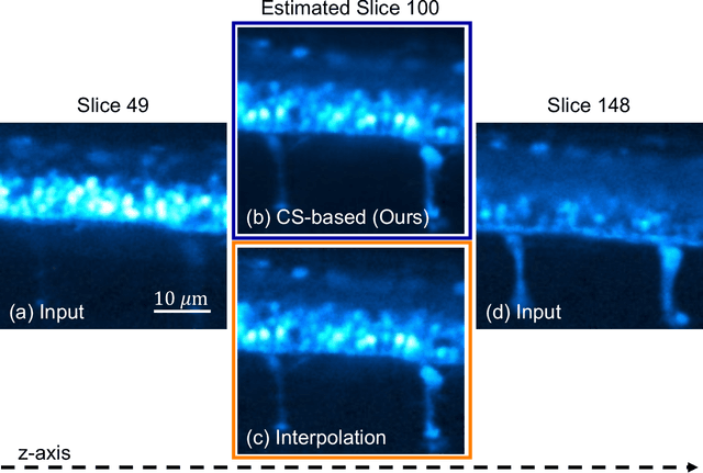 Figure 4 for Low dosage 3D volume fluorescence microscopy imaging using compressive sensing