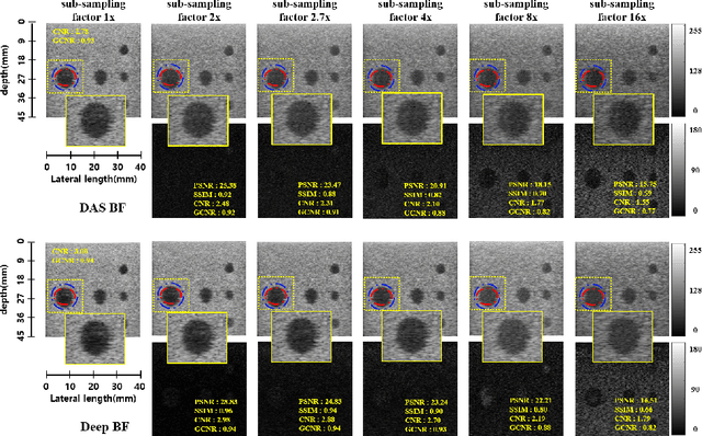 Figure 4 for Deep Learning-based Universal Beamformer for Ultrasound Imaging