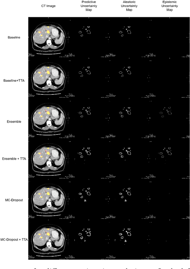 Figure 1 for Influence of uncertainty estimation techniques on false-positive reduction in liver lesion detection