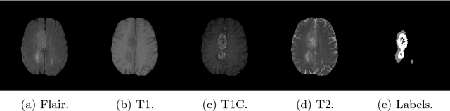 Figure 3 for Conditional Random Fields as Recurrent Neural Networks for 3D Medical Imaging Segmentation