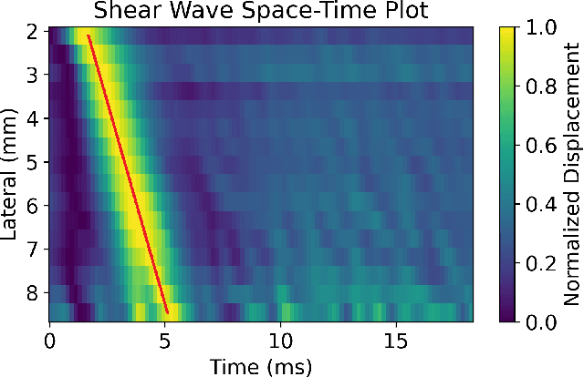 Figure 1 for SweiNet: Deep Learning Based Uncertainty Quantification for Ultrasound Shear Wave Elasticity Imaging