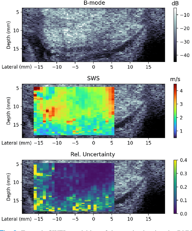 Figure 3 for SweiNet: Deep Learning Based Uncertainty Quantification for Ultrasound Shear Wave Elasticity Imaging