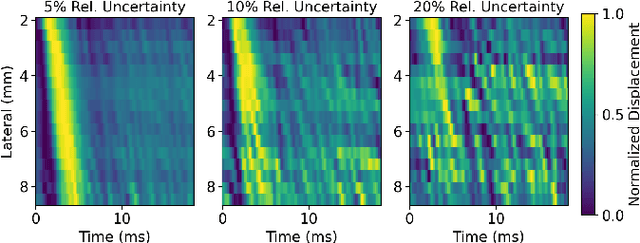 Figure 4 for SweiNet: Deep Learning Based Uncertainty Quantification for Ultrasound Shear Wave Elasticity Imaging