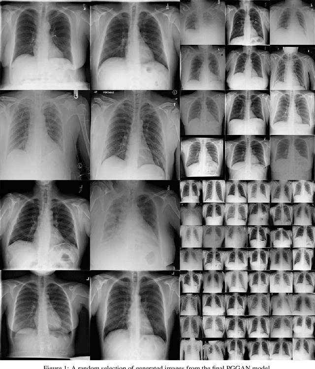 Figure 1 for Synthesising clinically realistic Chest X-rays using Generative Adversarial Networks