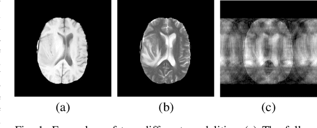 Figure 1 for Multi-modal Aggregation Network for Fast MR Imaging