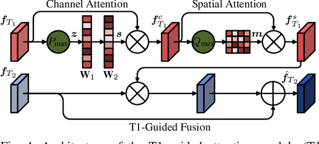 Figure 4 for Multi-modal Aggregation Network for Fast MR Imaging