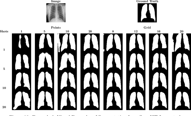 Figure 3 for Weakly Supervised Medical Image Segmentation