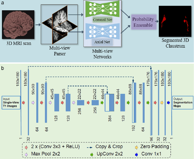 Figure 3 for Complex Grey Matter Structure Segmentation in Brains via Deep Learning: Example of the Claustrum