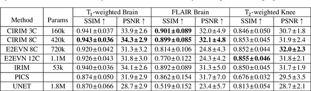 Figure 4 for Assessment of Data Consistency through Cascades of Independently Recurrent Inference Machines for fast and robust accelerated MRI reconstruction