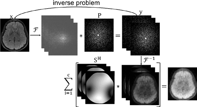 Figure 1 for Assessment of Data Consistency through Cascades of Independently Recurrent Inference Machines for fast and robust accelerated MRI reconstruction