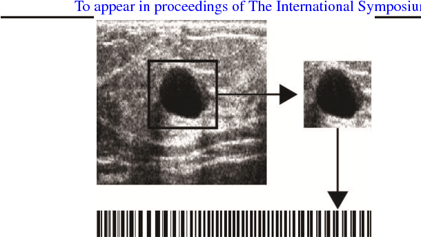 Figure 2 for Tumour ROI Estimation in Ultrasound Images via Radon Barcodes in Patients with Locally Advanced Breast Cancer