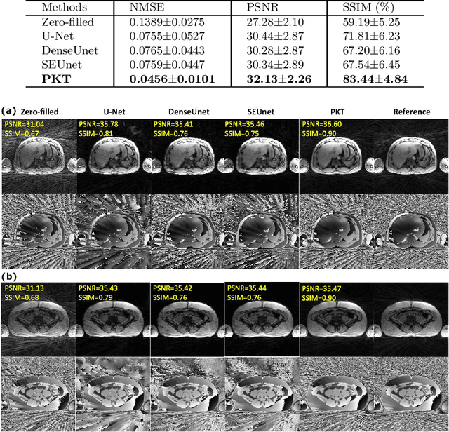 Figure 2 for A Projection-Based K-space Transformer Network for Undersampled Radial MRI Reconstruction with Limited Training Subjects