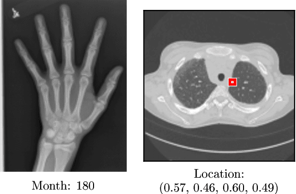 Figure 3 for Quantifying Predictive Uncertainty in Medical Image Analysis with Deep Kernel Learning