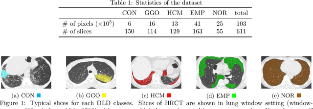 Figure 1 for Weak Supervision in Convolutional Neural Network for Semantic Segmentation of Diffuse Lung Diseases Using Partially Annotated Dataset