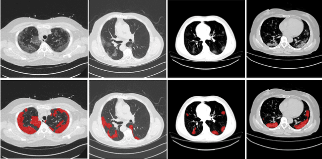 Figure 1 for Exploiting Shared Knowledge from Non-COVID Lesions for Annotation-Efficient COVID-19 CT Lung Infection Segmentation