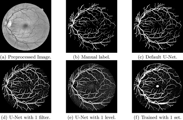 Figure 4 for What Do We Really Need? Degenerating U-Net on Retinal Vessel Segmentation