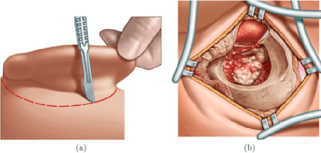 Figure 1 for Contributions à l'asservissement visuel et à l'imagerie en médecine
