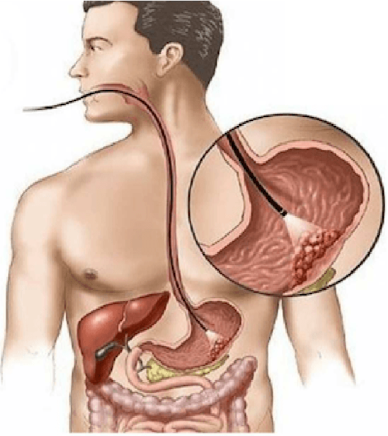 Figure 4 for Contributions à l'asservissement visuel et à l'imagerie en médecine