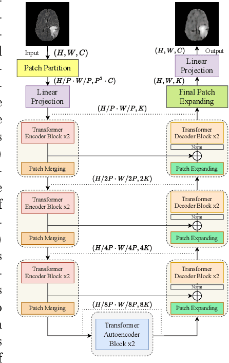 Figure 1 for Transformer based Models for Unsupervised Anomaly Segmentation in Brain MR Images