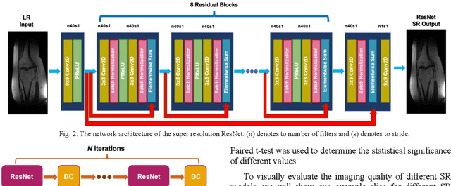 Figure 2 for Magnitude-image based data-consistent deep learning method for MRI super resolution