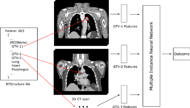 Figure 1 for Metastatic Cancer Outcome Prediction with Injective Multiple Instance Pooling